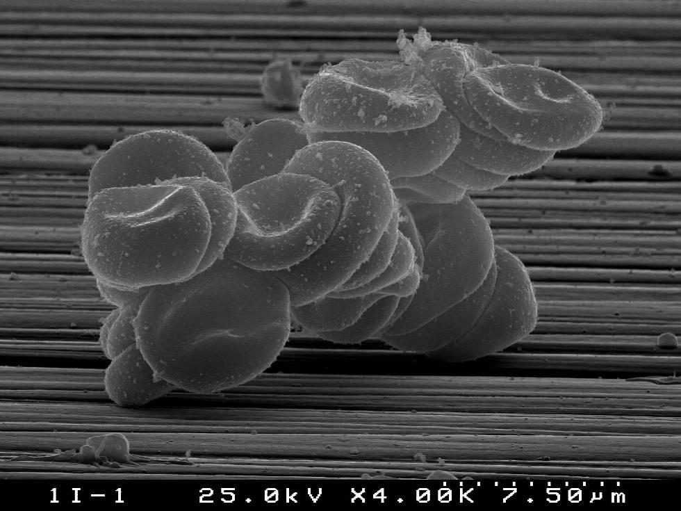 Red cells attachment on rough ceramic surface (S.Agathopoulos)
