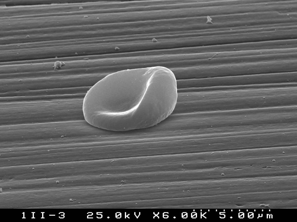 Red cells attachment on rough ceramic surface (S.Agathopoulos)