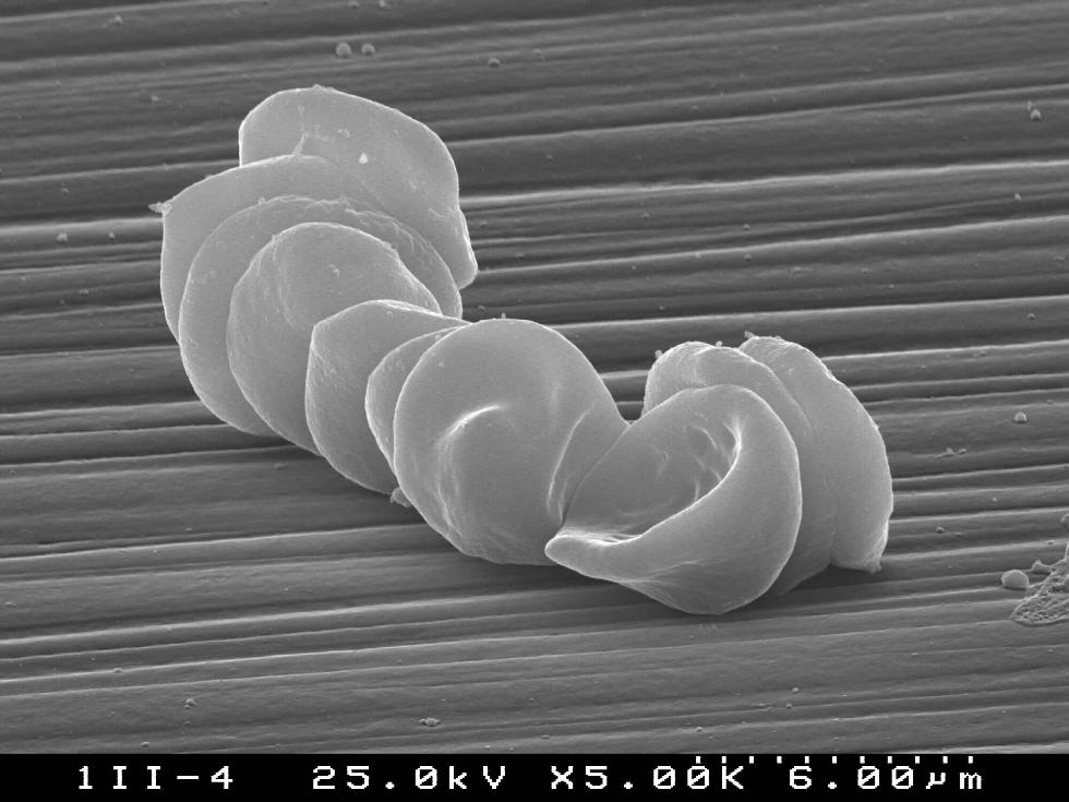 Red cells attachment on rough ceramic surface (S.Agathopoulos)