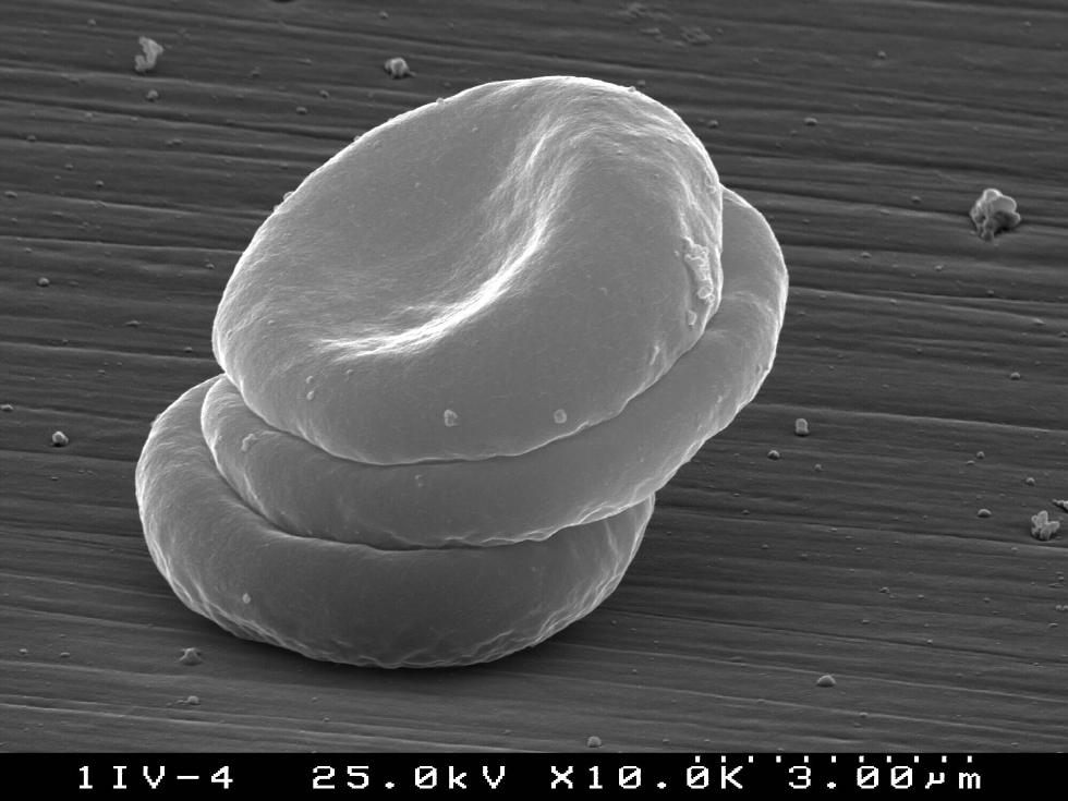 Red cells attachment on rough ceramic surface (S.Agathopoulos)