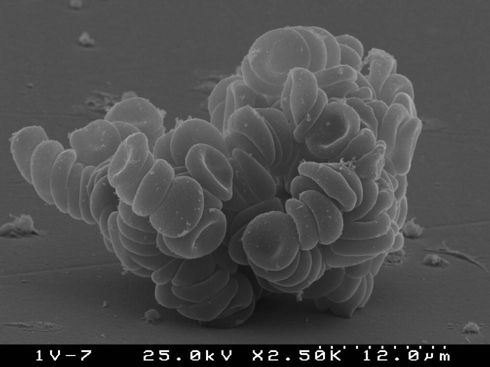 Red cells attachment on rough ceramic surface (S.Agathopoulos)